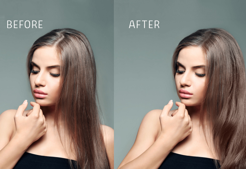 FRAUEN HAARTRANSPLANTATION